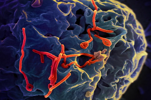 Wkład firm z Hull w walkę z wirusem Ebola